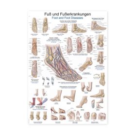 Plakat Stopalo in bolezni stopal, 100x70cm
